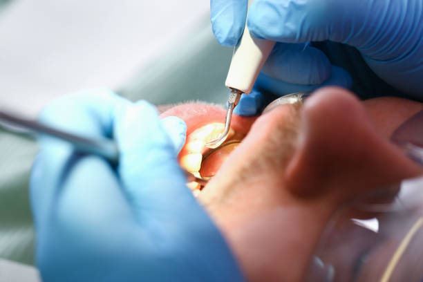 Best Walk-In Emergency Dental Services in West Ack, NY