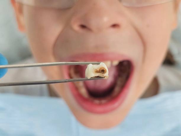 Best Emergency Orthodontic Repairs in West Ack, NY